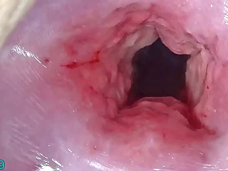 Uncensored Japanese Cervix Stretching and Uterus Dilation with Penetration