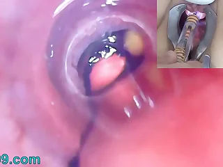 Mature Chick Peehole Endoscope Camera there Bladder with Balls